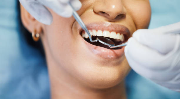 Best Emergency Tooth Extraction in Oil City, PA